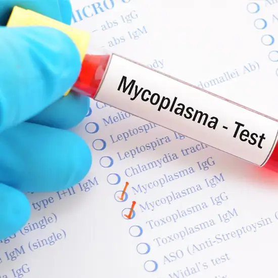 Mycoplasma Pneumoniae IgG, Serum Test